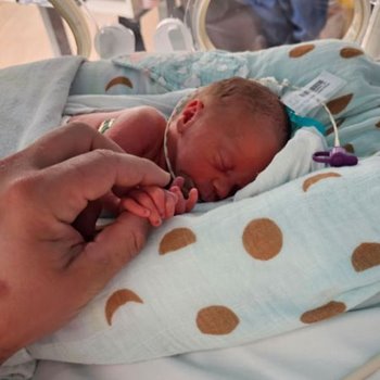 Born 10 weeks early, little miracle Imelda wins fight for life 